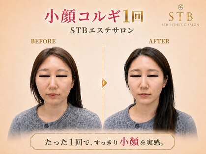 STBエステサロンの写真
