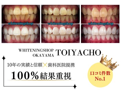 ホワイトニングショップ 岡山問屋町店の写真