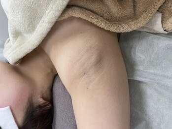 ナノハナ/鹿沼市全身脱毛美容室ナノハナ