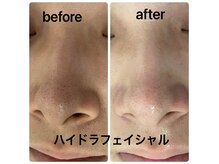 リラックスアンドビューティ(Relax&Beauty)の雰囲気（最新型毛穴洗浄マシン導入！毛穴洗浄が得意＆自慢のサロンです♪）