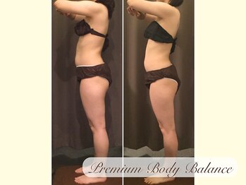 美プレミアム 越谷店/９、施術結果