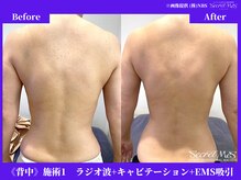 フェレザ 新潟(Felleza)/基本は2週間に1回がベスト！