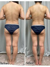 FJ/薄着の季節に向けて◇全身痩身！