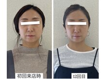 ラボーテヴェリテ(La Beaute Verite)/【お客様施術例】