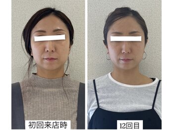 ラボーテヴェリテ(La Beaute Verite)/【お客様施術例】