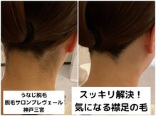 プレヴェール 神戸三宮/うなじ脱毛