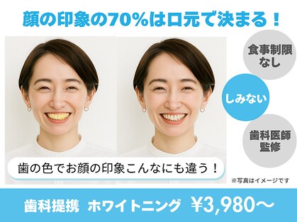 ホワイトニングカフェ 秋葉原店(WhiteningCafe)の写真