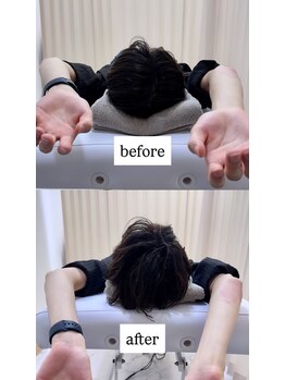 ルーツ 渋谷店(R∞ts)/姿勢改善（猫背・巻肩・肩コリ）