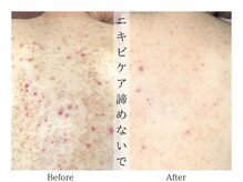 リララ(lelala)/ビフォーアフター☆