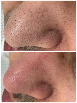 サイセイ(SAISEI)/