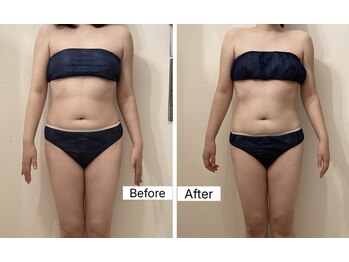 ルシエル ハカタ(Luciel HAKATA)/痩身120分×3回(30代)