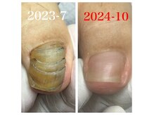 【肥厚爪変形爪ケア専門店】専門スタッフにお任せ下さい！！