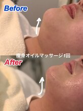 シイ(She)/痩身オイルマッサージ