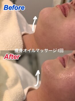 シイ(She)/痩身オイルマッサージ