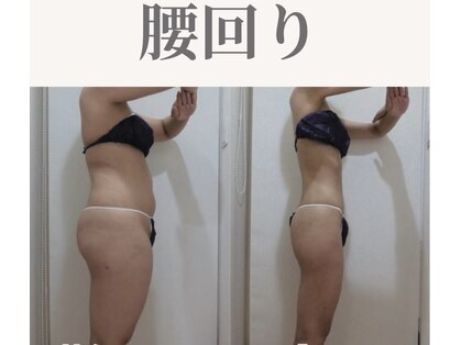 Nビューティーの写真