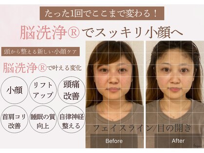 ベル(belle)の写真