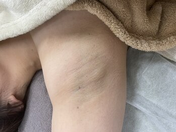 ナノハナ/鹿沼市全身脱毛美容室ナノハナ