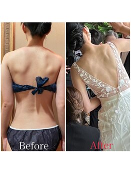 ビューティースタイリング 自由が丘店(beauty styling)/【ブライダル】背中・肩・二の腕