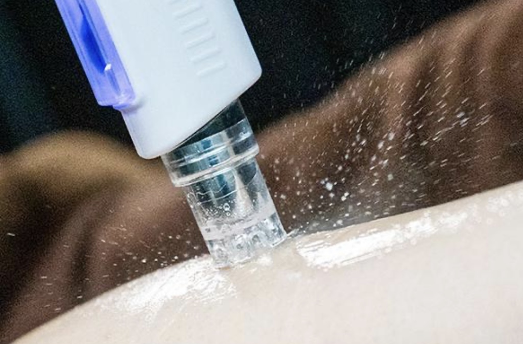 エムドット(M.)/鍼を刺さない美容★エアバリ