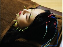 くにたちNyan鍼灸整体院/美容鍼＆頭皮鍼★