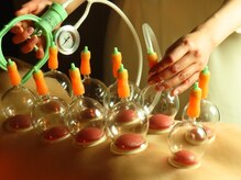 ココシア(COCOSIA)の雰囲気(男性利用OK!お気軽に♪吸い玉も人気です♪)