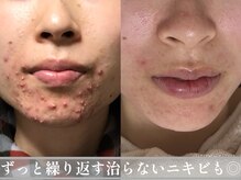 マボーテ 恵比寿(Ma-Beaute)
