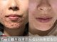マボーテ 恵比寿(Ma-Beaute)の写真