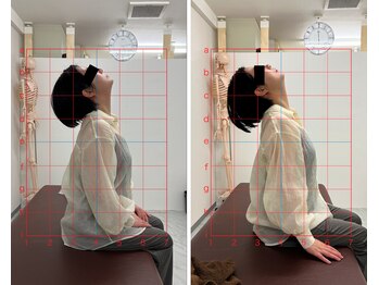 トワニ整体 新富町院(TOWANI整体)/姿勢/銀座/新富町/築地/整体