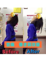 ヒデ整体院(Hide整体院)/猫背矯正骨盤矯正B/A肩こり腰痛