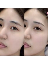 チル アンド アイ 船橋駅前店(Chill&Eye)/まつ毛パーマ+美眉スタイリング