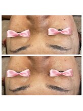 美温(mion)/肌ツヤ、はり感アップ