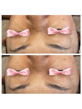 美温(mion)/肌ツヤ、はり感アップ