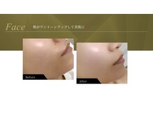 ベラ(VERA)の雰囲気（結果重視のPRO施術）