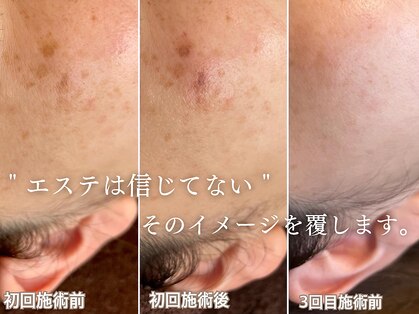 リプラス(RE.PLUS)の写真