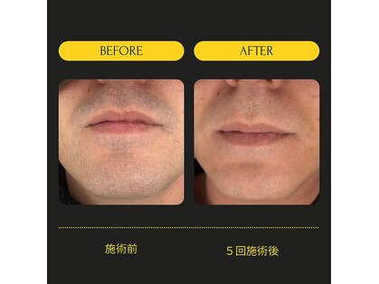 ラポール(Rapport)の写真