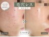 【潤う毛穴レス肌に】陶肌トリートメント/毛穴ケアのオプション付き