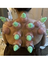 ソルーナ(So-Luna)/カッピング