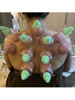 ソルーナ(So-Luna)/カッピング