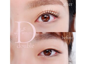 エーケー(AK)/ダブルアイリフト