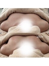 アヴェラーレ(avverare)/バストアップモニター様募集中！