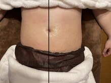 イヴ(Yves)/ハイパーナイフbefore/after