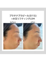 ポムハヌル 大阪梅田中崎町(pom.haneul)/韓国肌管理室