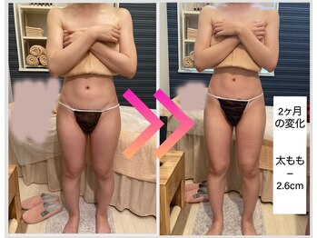 ヴィオラ(Viola)/足のシェイプアップも!