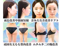 ボナボナ 仙台立町(BONA BONA)の雰囲気（【短期集中】面長改善小顔コルギ/歪み左右差/太もも/二の腕/痩身）