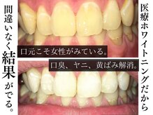 ジェントルメンズグロー(Gentlemen’s Glow)/【セルフホワイトニング】