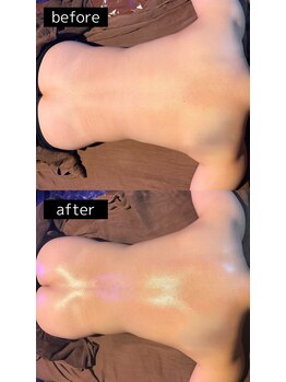 ヴィズコレクトビューティ(VIZ CORRECT BEAUTY)/背中～ヒップラインの引き締め◎