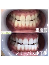 ルブラン 奈良店(Le Blanc)/美しい歯で印象UP♪
