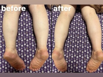 イールーム(eroom)/温熱リンパケアはむくみにも◎