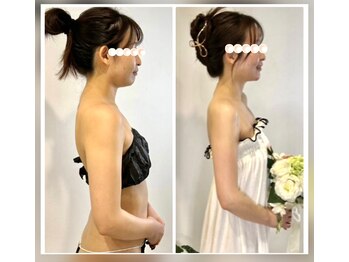 ソウ バイ ソウ(So by 蒼)/機器の表層的アプローチは↓