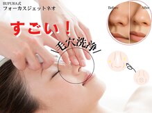 ブプラ 行橋店(BUPURA)の雰囲気（お悩み別×美肌ケアで徹底肌管理！！）